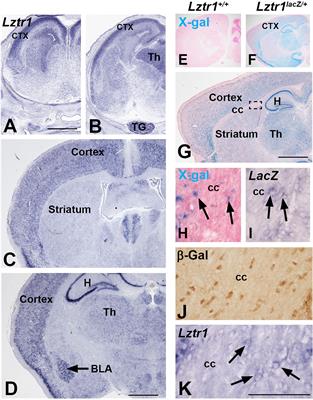 Generation of a Mouse Model to Study the Noonan Syndrome Gene Lztr1 in the Telencephalon